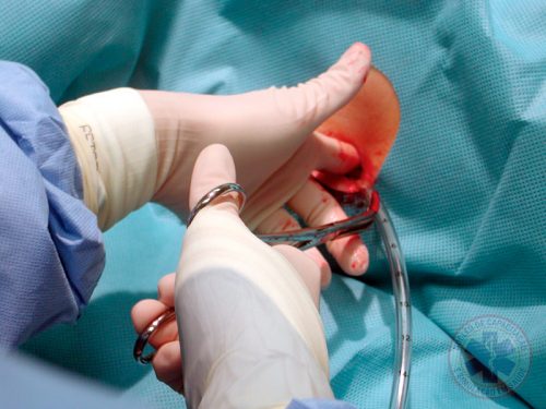 Procedimentos Invasivos na Emergência